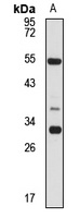 Anti-C9orf72 Antibody