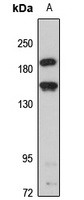 CADPS2 antibody