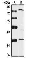 Anti-CALHM2 Antibody