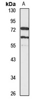 Anti-CaMKK alpha Antibody