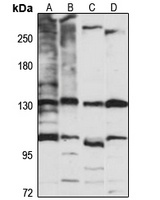 Anti-TIP120A Antibody