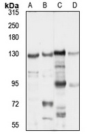 TIP120B antibody