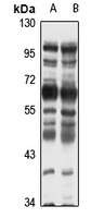 Anti-CBX2 Antibody