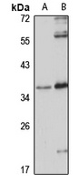 CCDC137 antibody