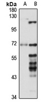 Anti-CCDC6 Antibody