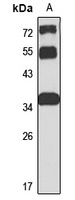 Anti-CCDC92 Antibody