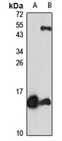 Anti-CCL20 Antibody