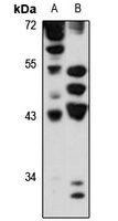 Anti-GCIP Antibody