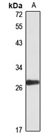 Anti-CD320 Antibody