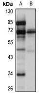 Anti-CAST Antibody