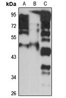 CDCA7L antibody