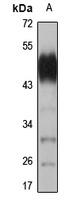 CDK14 antibody