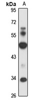Anti-CDK18 Antibody