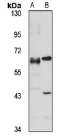 Anti-CDK5RAP1 Antibody