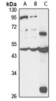 CDKAL1 antibody