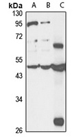 Anti-CDKAL1 Antibody
