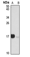 Anti-p16 INK4a Antibody