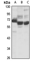 Anti-CDKN2AIP Antibody