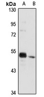 CDS2 antibody