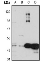 CDSN antibody