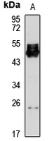 Anti-CEACAM4 Antibody