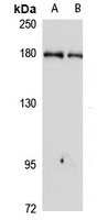 CEMIP antibody
