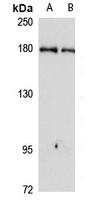 Anti-CEMIP Antibody