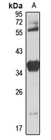 Anti-CENPK Antibody