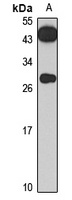 Anti-CENPQ Antibody