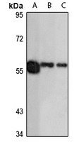 Anti-CES3 Antibody