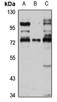 FHR-5 antibody