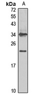 HCG antibody