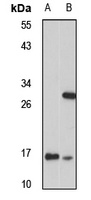 Anti-CHCHD2 Antibody