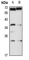 CHMP3 antibody