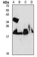 CHP1 antibody