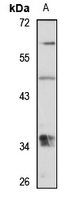Anti-CHPT1 Antibody