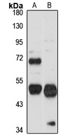 Anti-CHRDL1 Antibody