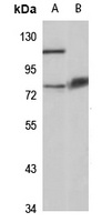 Anti-CHST15 Antibody