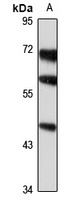 CHST5 antibody