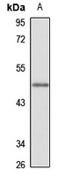 Anti-CIR Antibody