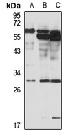 Anti-CITED2 Antibody