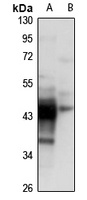 Anti-CKMT1A Antibody