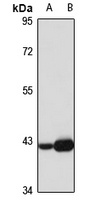 Anti-CKMT1B Antibody
