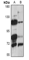 Anti-CLCA4 Antibody