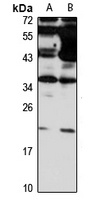 Claudin 14 antibody