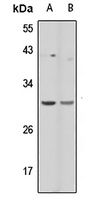 Anti-PCLN-1 Antibody
