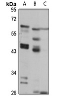 Anti-Claudin 18 Antibody