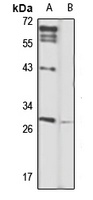 CLEC1B antibody