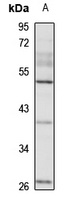 CLEC4G antibody