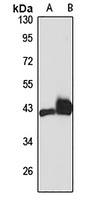 Anti-CB2 Antibody